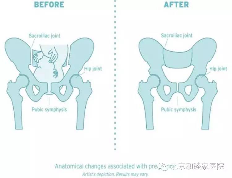 和睦家卫星诊所福利袭来：产后骨盆脊柱康复讲座报名ing