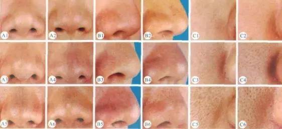 收缩毛孔省钱方法,收缩毛孔超级有效