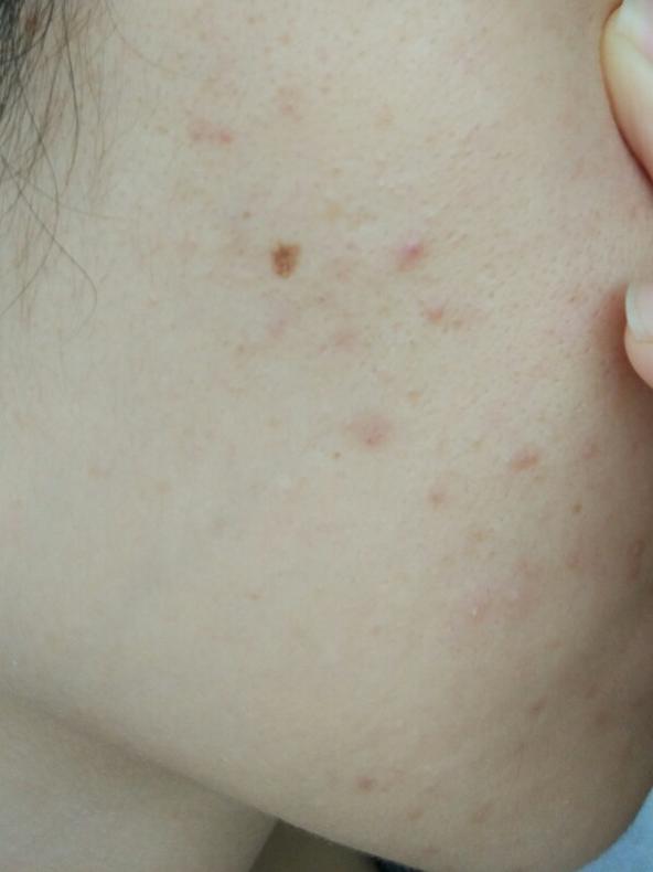 护肤一百问答,女孩健身护肤知识问答