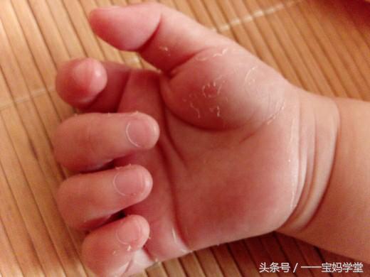 涨知识儿童,宝宝的这八种现象都是正常的