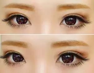 隐形眼镜碎了会在哪个位置,隐形眼镜在眼里面碎了一半