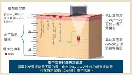 超声刀全部视频,超声刀图解全册