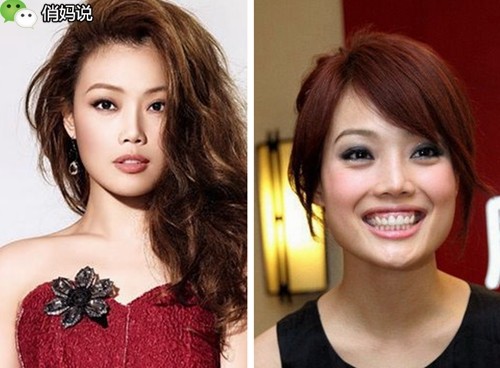 宝宝笑起来露牙龈是什么原因,6岁孩子露牙龈笑最简单改善方法