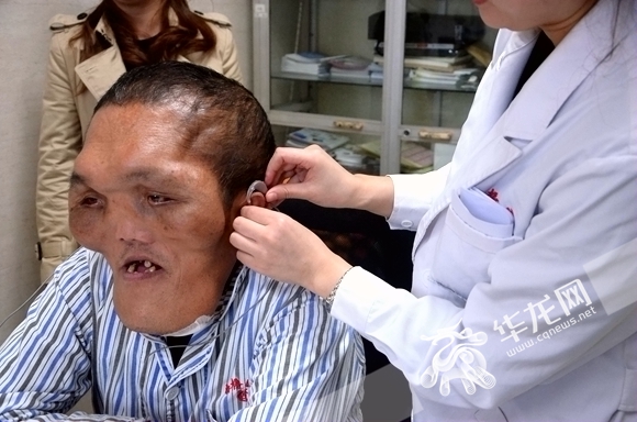 男子被怪病困扰十年,男子被怪病困扰20年