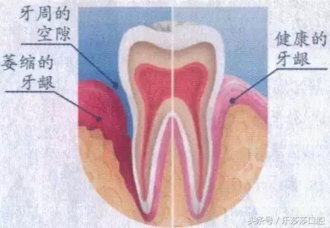 牙齿越长越往外凸怎么办,牙齿越来越长怎么回事