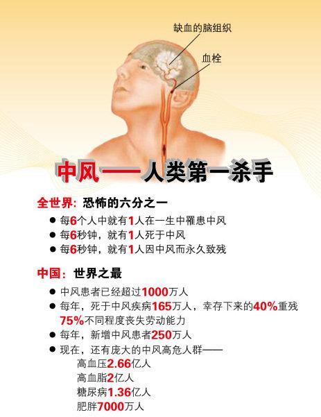 如何预防脑卒中视频,脑卒中为什么要做颈动脉彩超