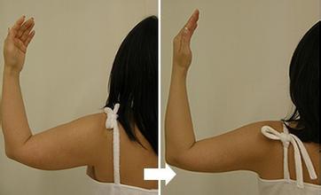 健身胳膊出汗瘦胳膊吗,胳膊转动可以瘦胳膊吗