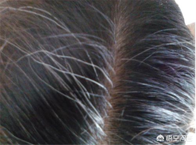 怀孕后为什么会长白头发,怀孕后白头发增多是怎么回事