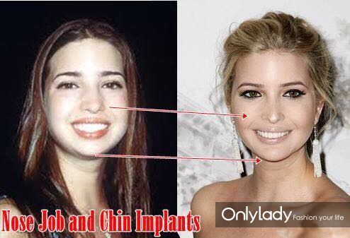 希拉里牙齿怎么样,希拉里的女儿怎么样