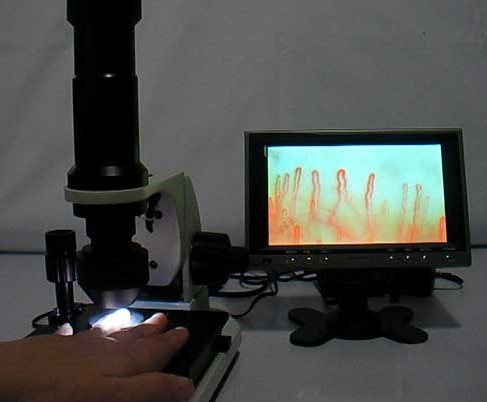 手脚冰凉无力是血液循环不流畅吗,手脚冰凉全身无力警惕三种病