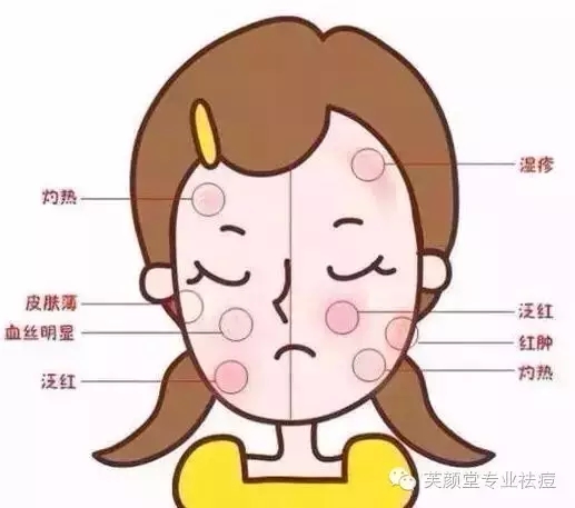 一到晚上脸部发红发烫怎么回事,冬天脸部发红发烫怎么快速缓解
