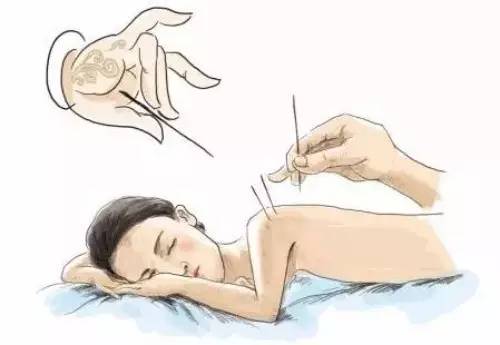 年轻人肩周炎是什么原因引起的,肩周炎是冬季高发期吗