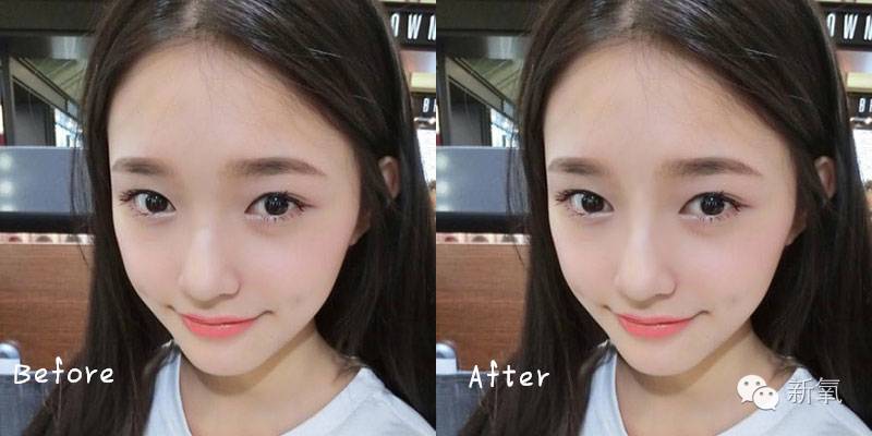 林允是不是整鼻子了,林允隆鼻过吗