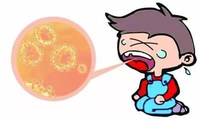 疱疹性咽峡炎可以吃什么药预防,小儿疱疹性咽峡炎的治疗