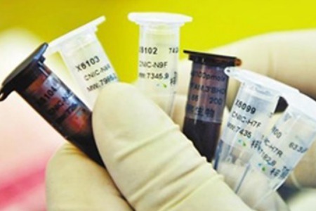 乙肝肝硬化之后肝功能会不会正常,乙肝肝硬化肝功能正常需要吃药吗