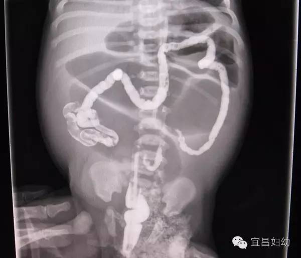 孩子腹胀属于什么科室,腹胀腹痛五十天了该做什么检查