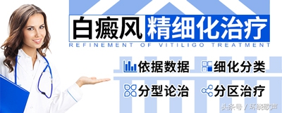 白癜风患者做到这几点不吃亏,白癜风治愈完全靠运气