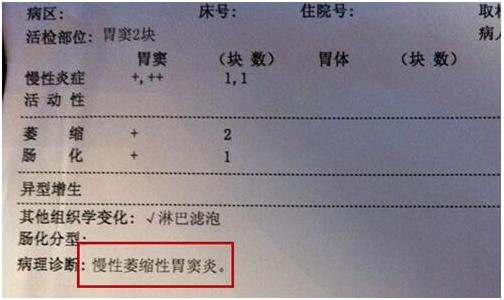 胃镜检查一定要活检才知道胃癌吗,胃镜活检怎么看出胃癌