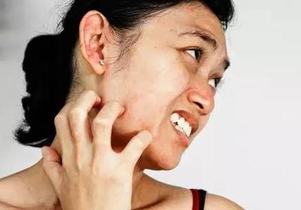 孕期皮肤太干燥引起痒的话怎么办,孕妈面部冬天干燥皮肤痒