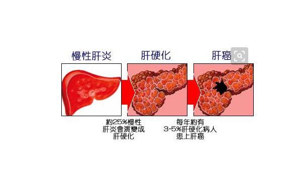 b超知识好不好学,b超要了解什么