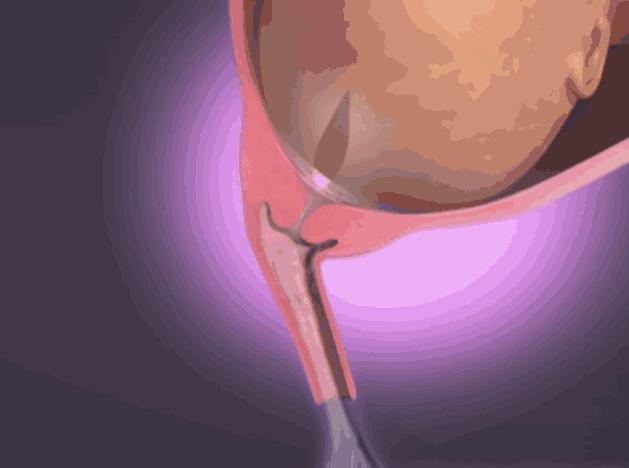 动画演示生孩子全过程，母亲的伟大你可懂？