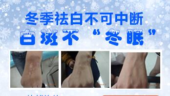 哪个季节治疗白癜风好得快,白癜风治疗有没有效果