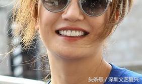 林允整牙效果怎么样,林允整牙后变化图片