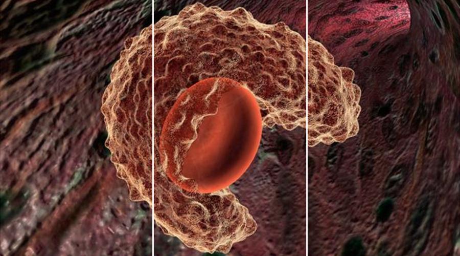 以色列TrioxNano公司让乳腺癌患者免受化疗之苦