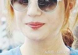 林允整牙效果怎么样,林允整牙后变化图片