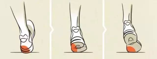 选鞋不当危害,跑鞋磨损内翻与外翻图解
