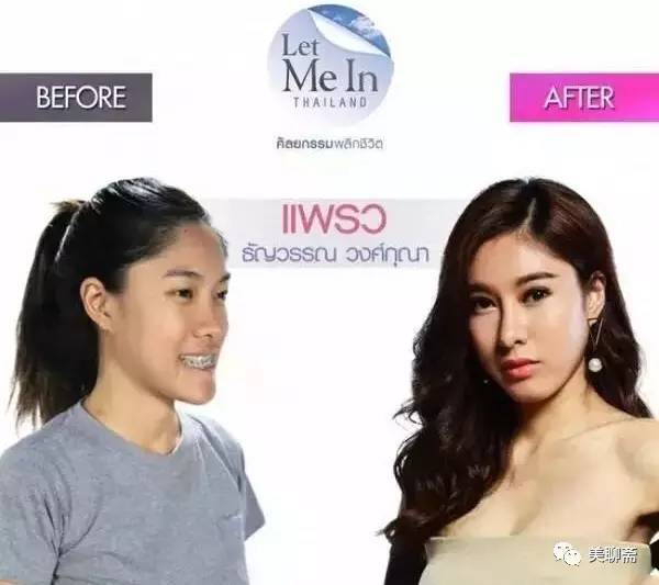 揭秘韩国整容术发达的原因,韩国整容业发达背后的原因