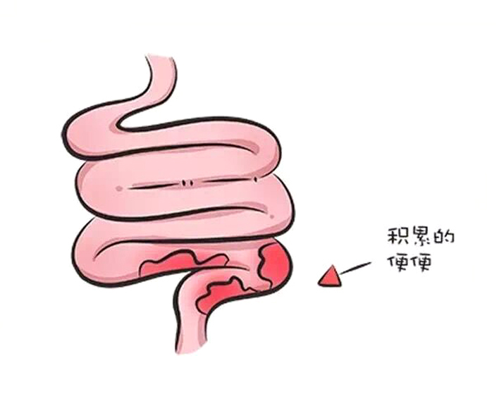 消化不好便秘吃什么食物可以调理,便秘要吃的十种食物彻底清除便秘