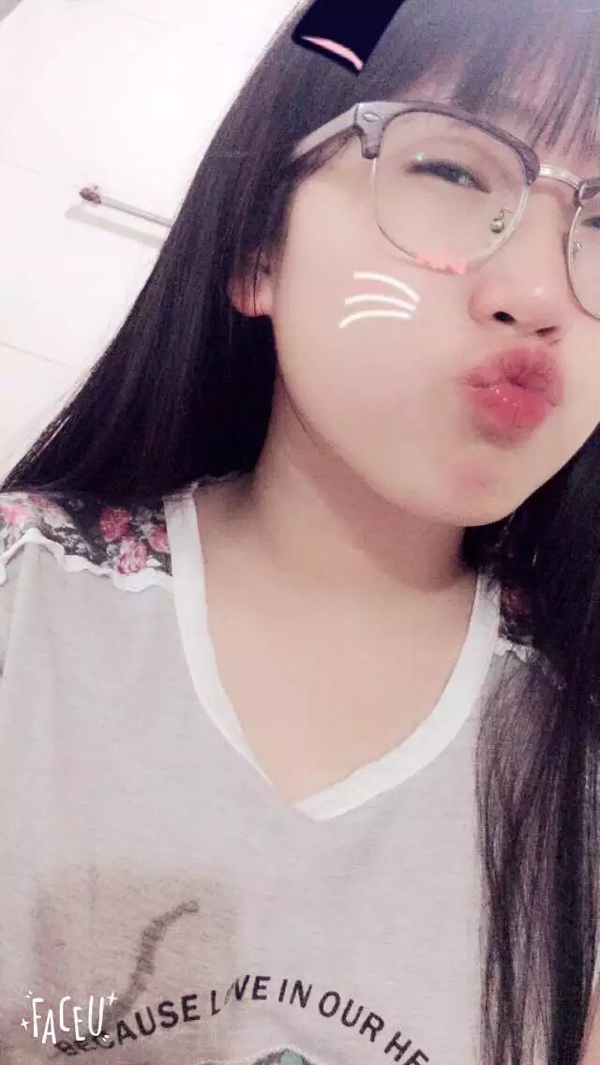 抽脂双眼皮做完眼睛有褶,割双眼皮肿成一条缝