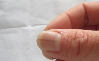 指甲都会有什么病症,指甲也会病变么