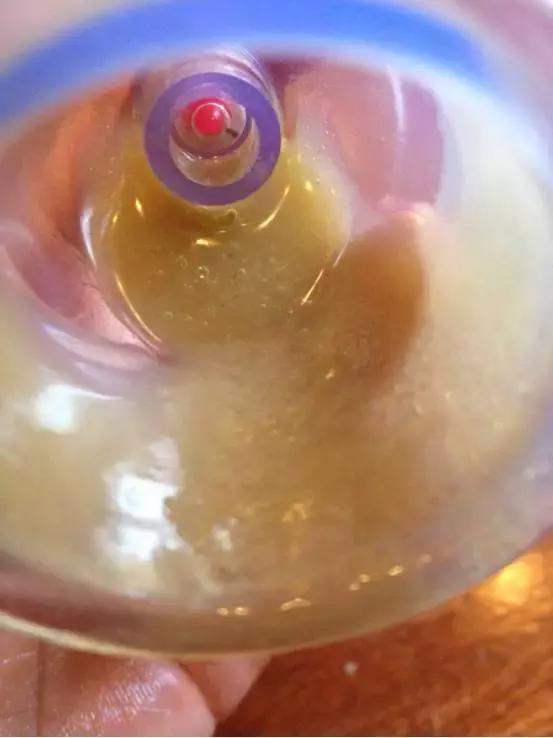 泌乳素39.39能不能治愈,泌乳素偏高中医怎么调