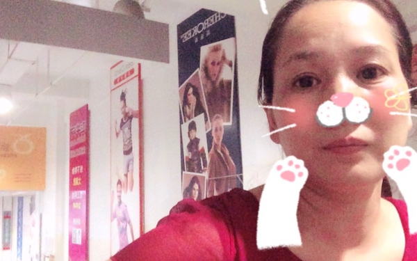 抽脂双眼皮做完眼睛有褶,割双眼皮肿成一条缝