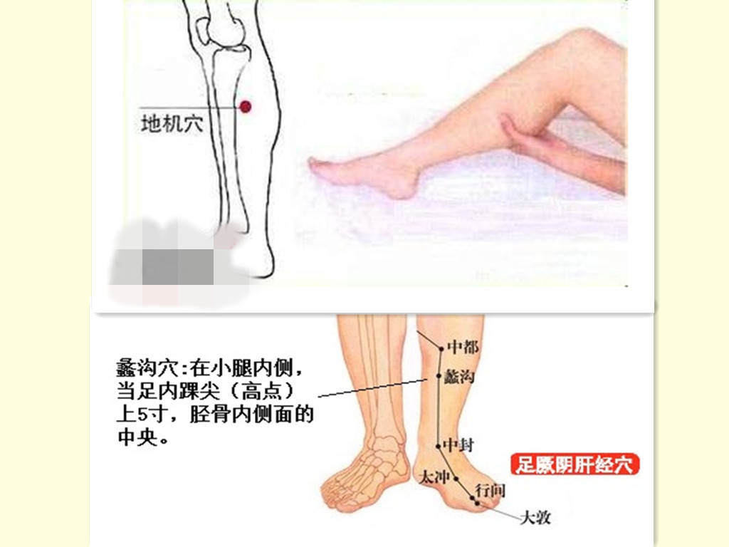 经期之痛，怎么解决痛苦，或许只有针灸才能一劳永逸！