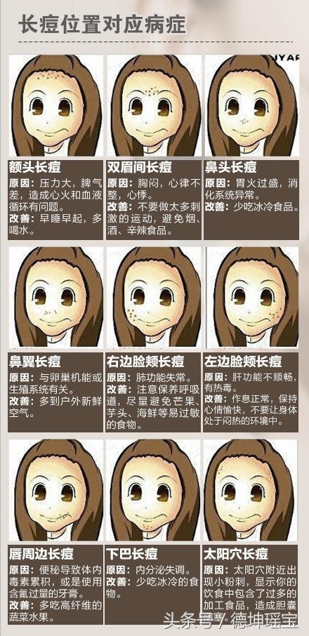 女子挤痘导致脸肿了,一女子挤痘痘脸部肿大