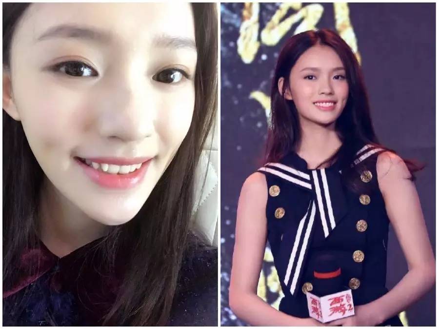 割双眼皮、垫鼻子、幽灵医生……一篇文章为你揭秘韩国整形