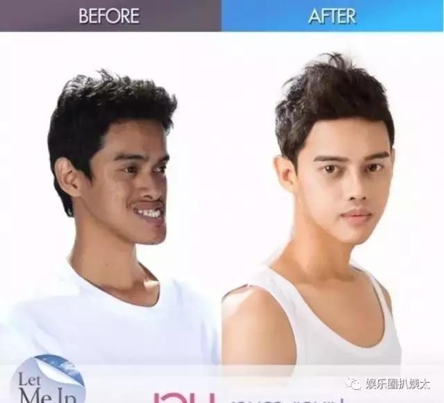 泰国专门的整容节目,泰国的整容节目有哪些