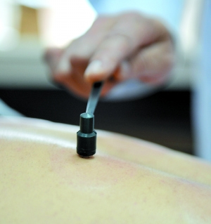 头部脂溢性皮炎,头油,头痒,头屑多,中医用1种针具扣刺