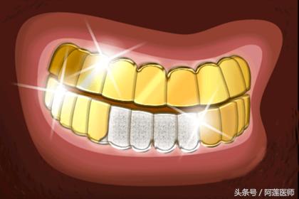 补牙后说话嘴巴不自然怎么办,补牙为什么吃饭不香