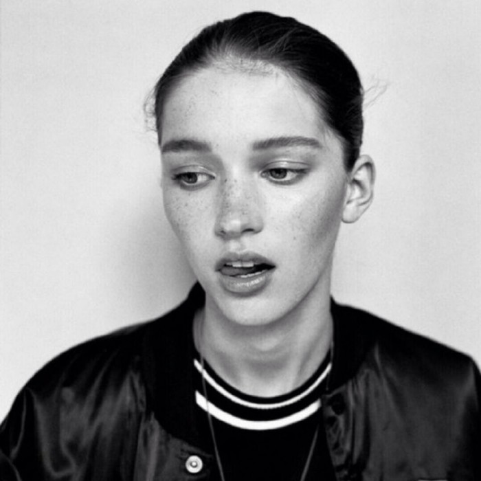 雀斑的治疗误区有哪些呢,雀斑治疗误区