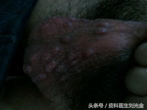 揭开谜团的真实事件,揭开皮肤病的真相