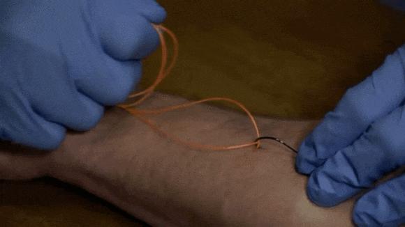 钓鱼时，不小心鱼钩刺进肉里，教你如何不疼的取出来