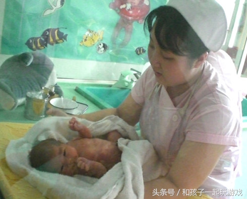 妊娠高血压症35周医院建议剖腹产,妊娠高血压28周剖腹产能存活么