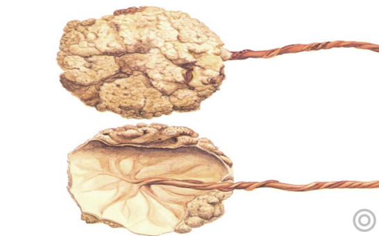 胎盘由什么和什么构成,胎盘由哪些构成有什么作用