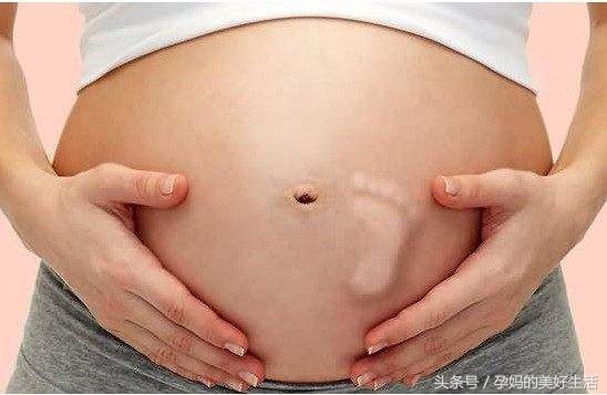 脐带绕颈3周纠正过来的成功案例,脐带绕颈一周可以做胎位纠正操吗