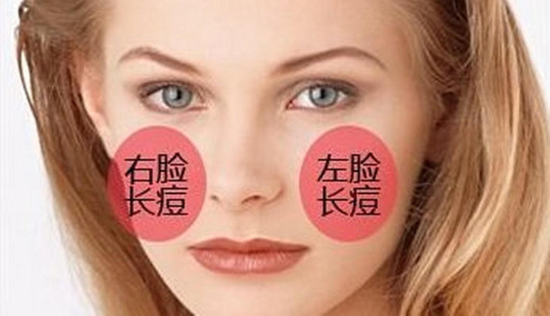 8张图让你秒懂长痘的原因,原来这才是长痘的真实原因