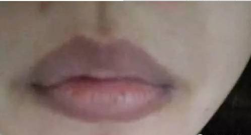 一旦嘴唇变成这种颜色就要警惕,嘴唇发黄要警惕这是一种常见疾病